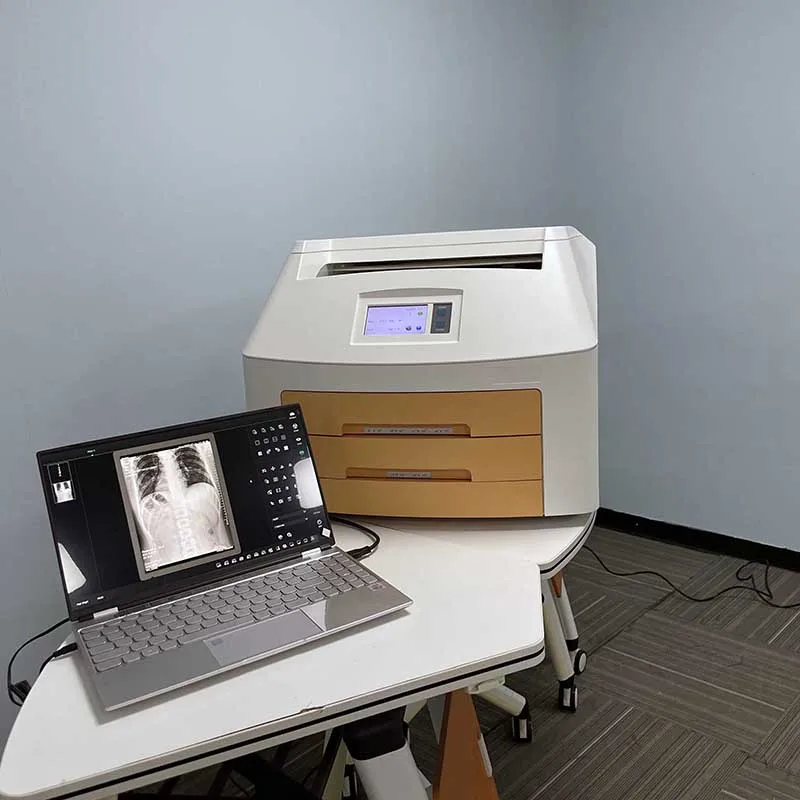 Medical X Ray Film Printer Dry Film Printer for DR System Thermo-graphic Flim Printing Machine