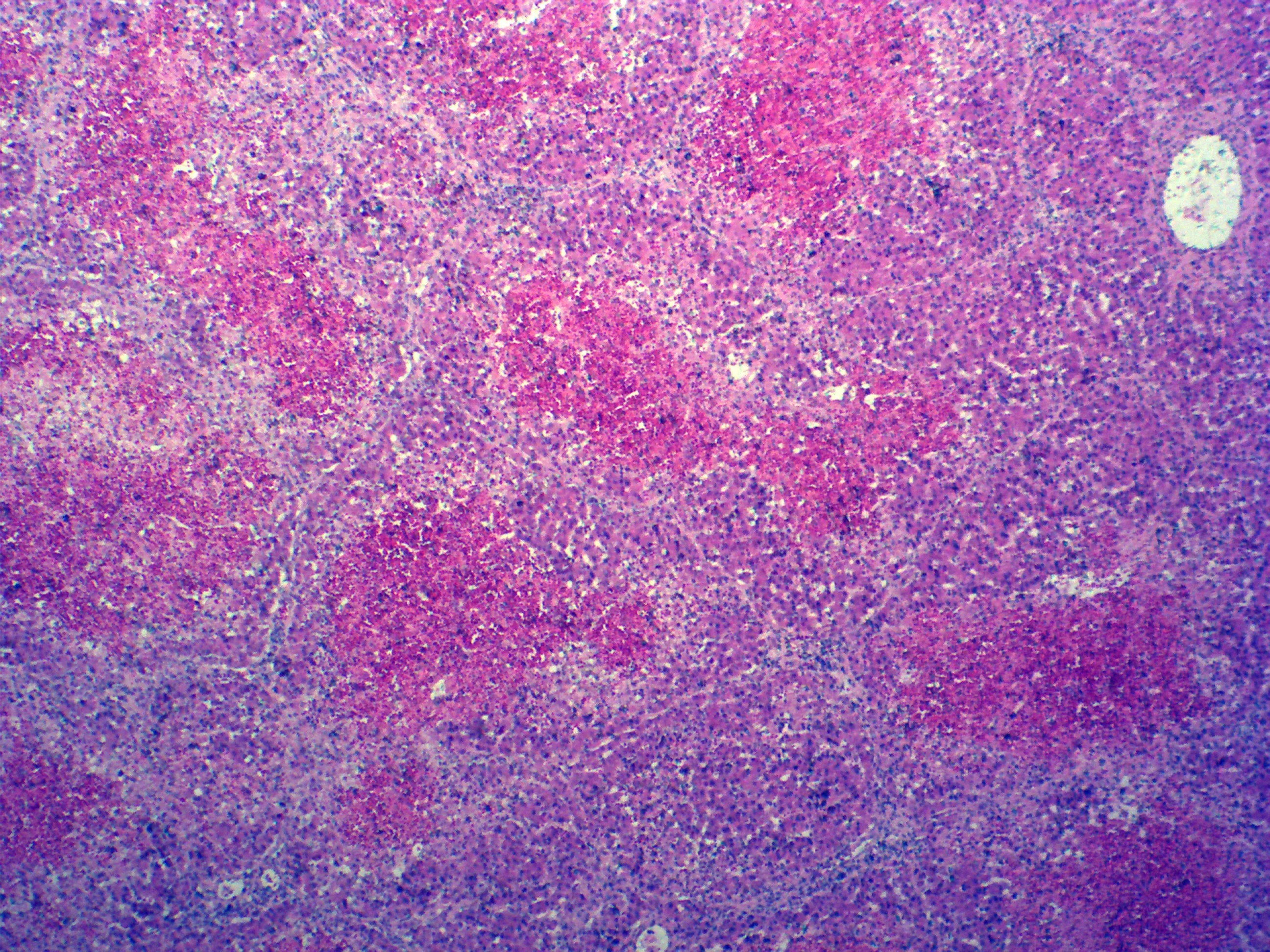 Medical biology laboratory human pathology preparation microscope slide specimen equipment