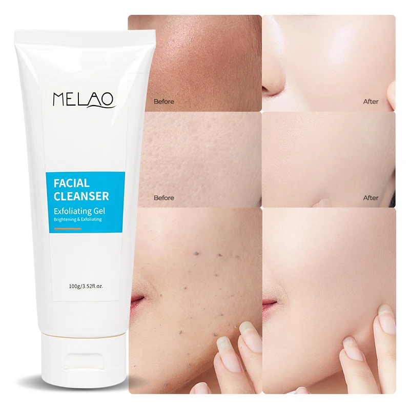 OEM ODM Facial Exfoliants Blackheads Enlarged Pores Wrinkles Skin Care Perfecting Exfoliating Peeling Gel Facial Cleanser (new)