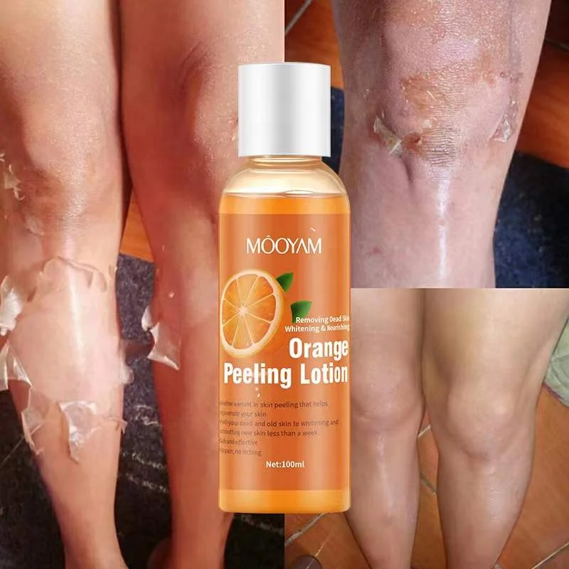 Wholesale organic aha bha skin care peel off lotion black skin whitening orange body peeling lotion