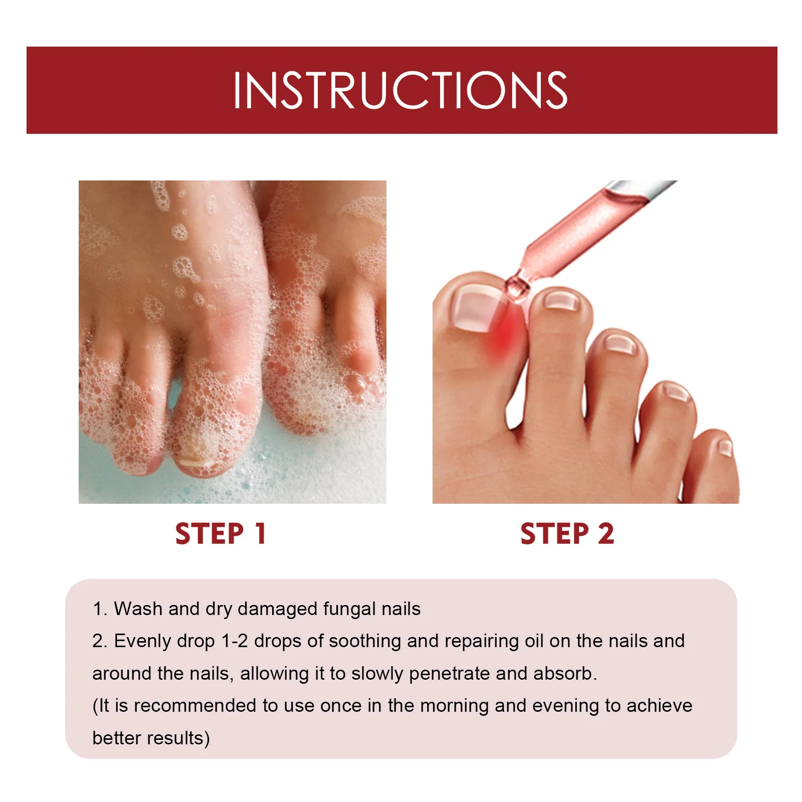 Nail Renewal Extra Strength Fungus Toe Fingernails Repair Liquid Renew Damaged Broken Nail 7 Days Nail Fungus Treatment