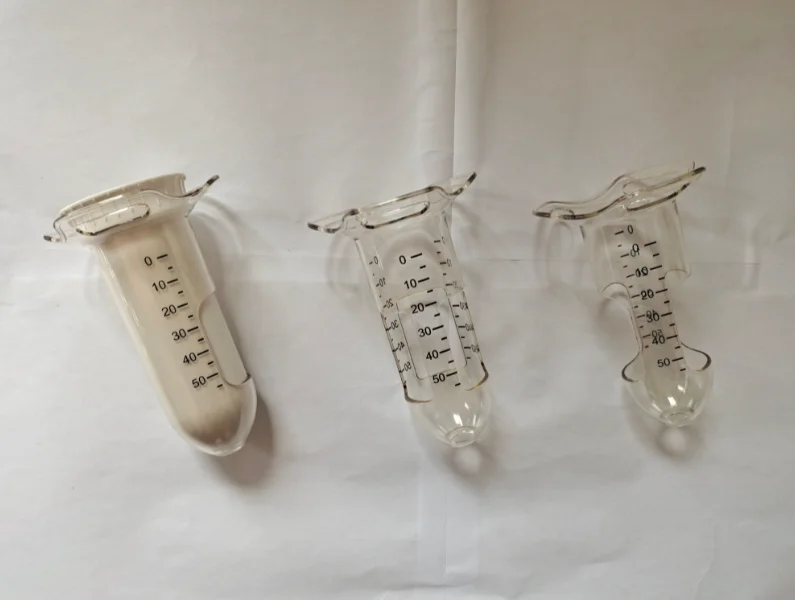 Wholesale Anorectal Surgical Hemorrhoid Disposable Plastic Anoscope Transparent Plastic Anal Speculum Anal Retractors