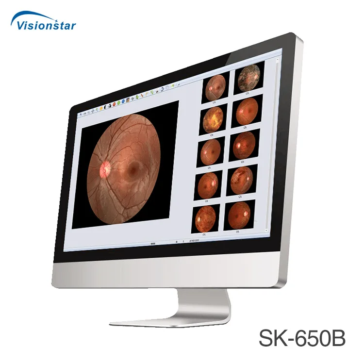 Popular Model SK-650B Non-mydriatic Fundus Camera