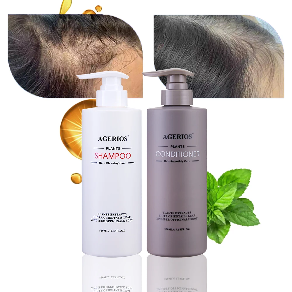 High-End Brand Agerios Silicone-Free Herbal Nature oil Control Moisturizing Hair Shampoo Cure Hair Loss