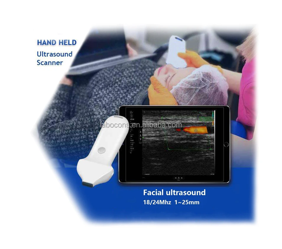 LANNX Airscan Faci6 In stock Color USG Scanner 3 in 1 ultrasound Probe for Mapping Injection Wireless Portable Probe Ultrasound