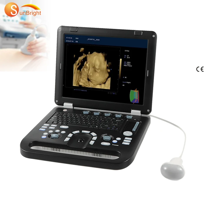3D color Doppler ultrasound equipment PW ultrasound CW diagnostic system