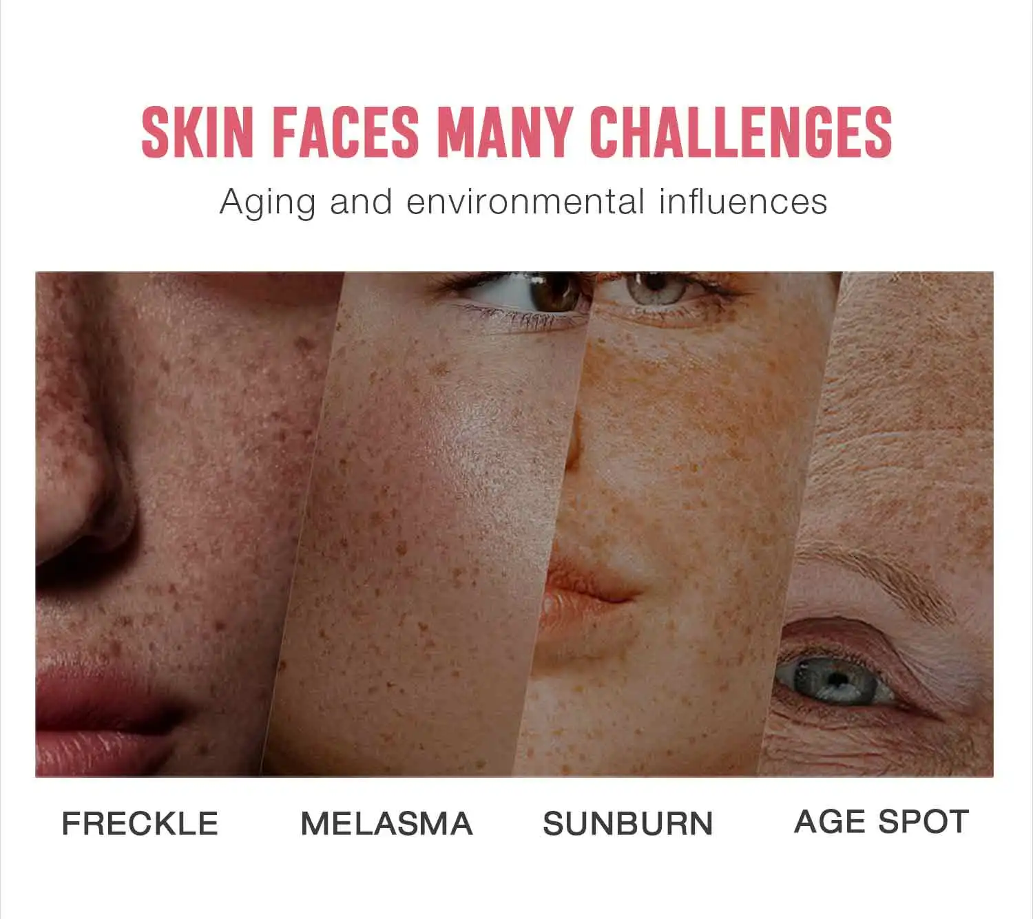 High quality Freckle Removal Face Cream, Private Label Removal Dark Spot Corrector Skin, OEM ODM Skincare Products