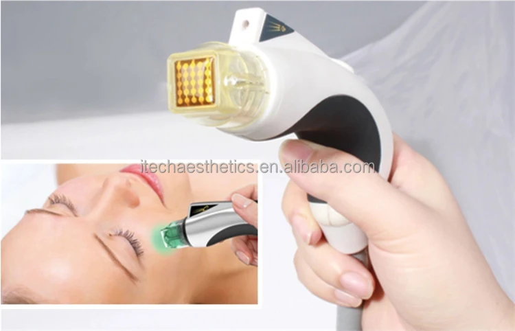 Beauty SPA/Salon use Non Invasive Microneedle Fractional RF Machine No Needle Fractional RF System MR20-1SP