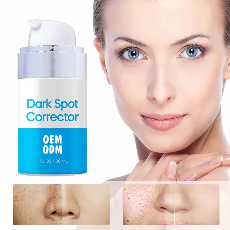 Hyperpigmentation Treatment Age Spot Remover Brightening Dark Spot Remover Dark Spot Corrector Cream for Body and Face