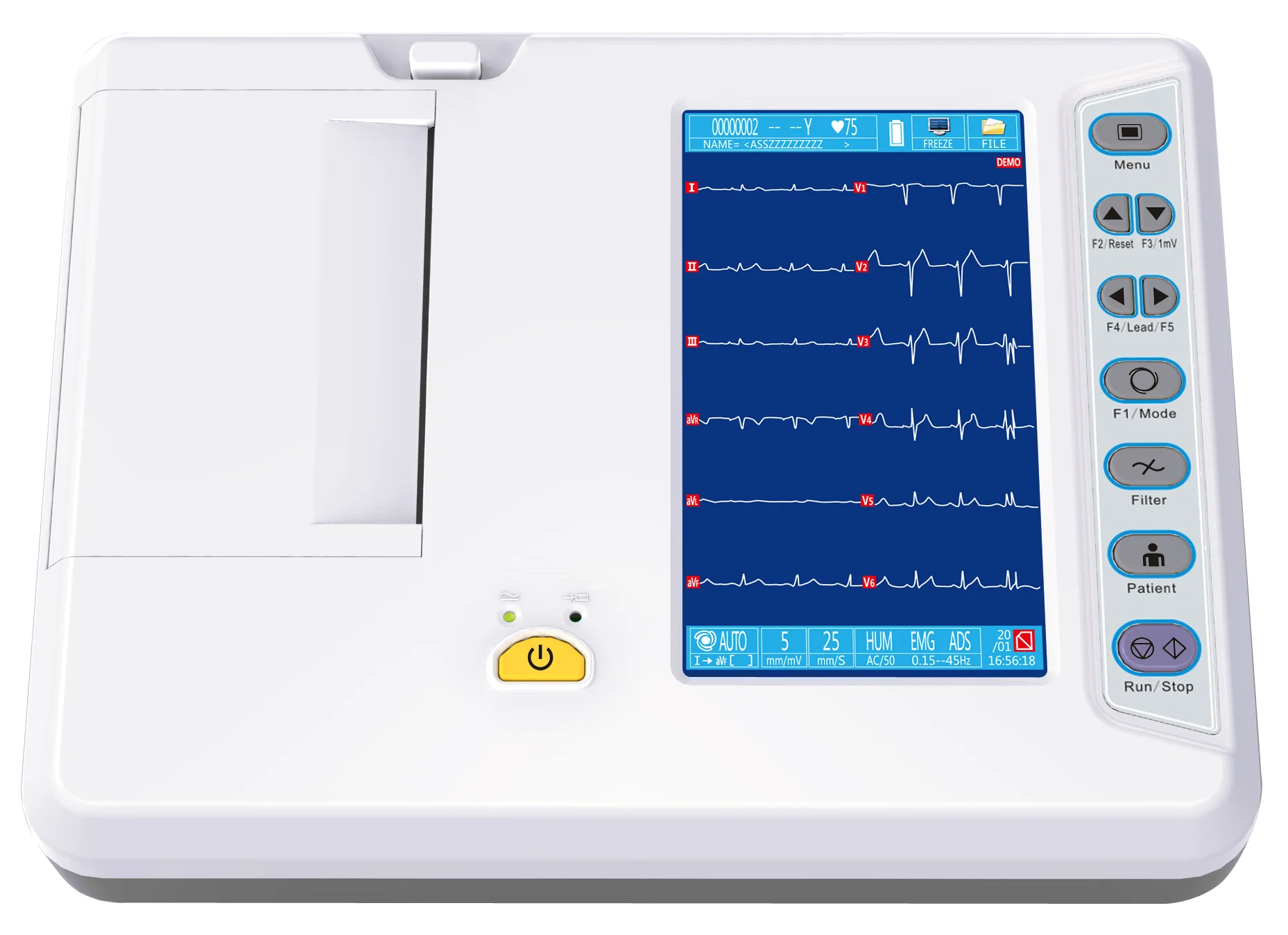 RC-ECG3306B ecg machines 6 channel portable price portable ecg machine