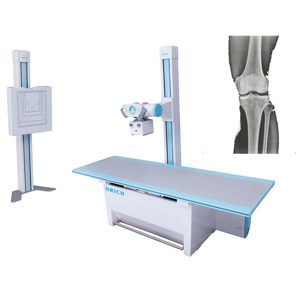 50kw 80kw High frequency digital radiography x ray machine price for medical radiology equipment x-ray inspection machine