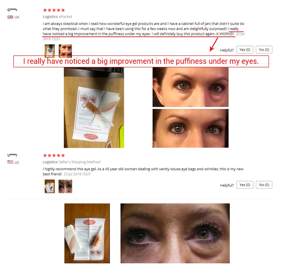 Original Omy Lady eye cream anti wrinkle dark circle removal eye cream for removing eyebags