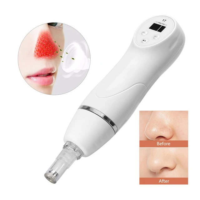 OEM Brand Acne Pore Deeply Cleaner USB Rechargeable Electric Vacuum Blackhead Remover With Diamond Head