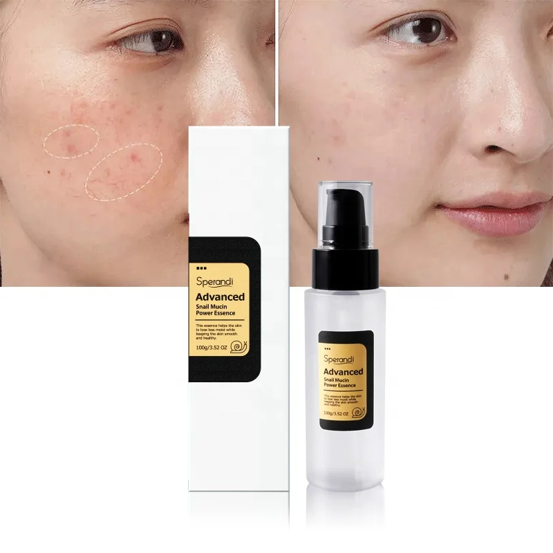 Wholesale Korean 96% Snail Mucin Skincare Anti Aging Skin Care Face Serum Facial Whitening Repair Snail Serum For Sensitive Skin