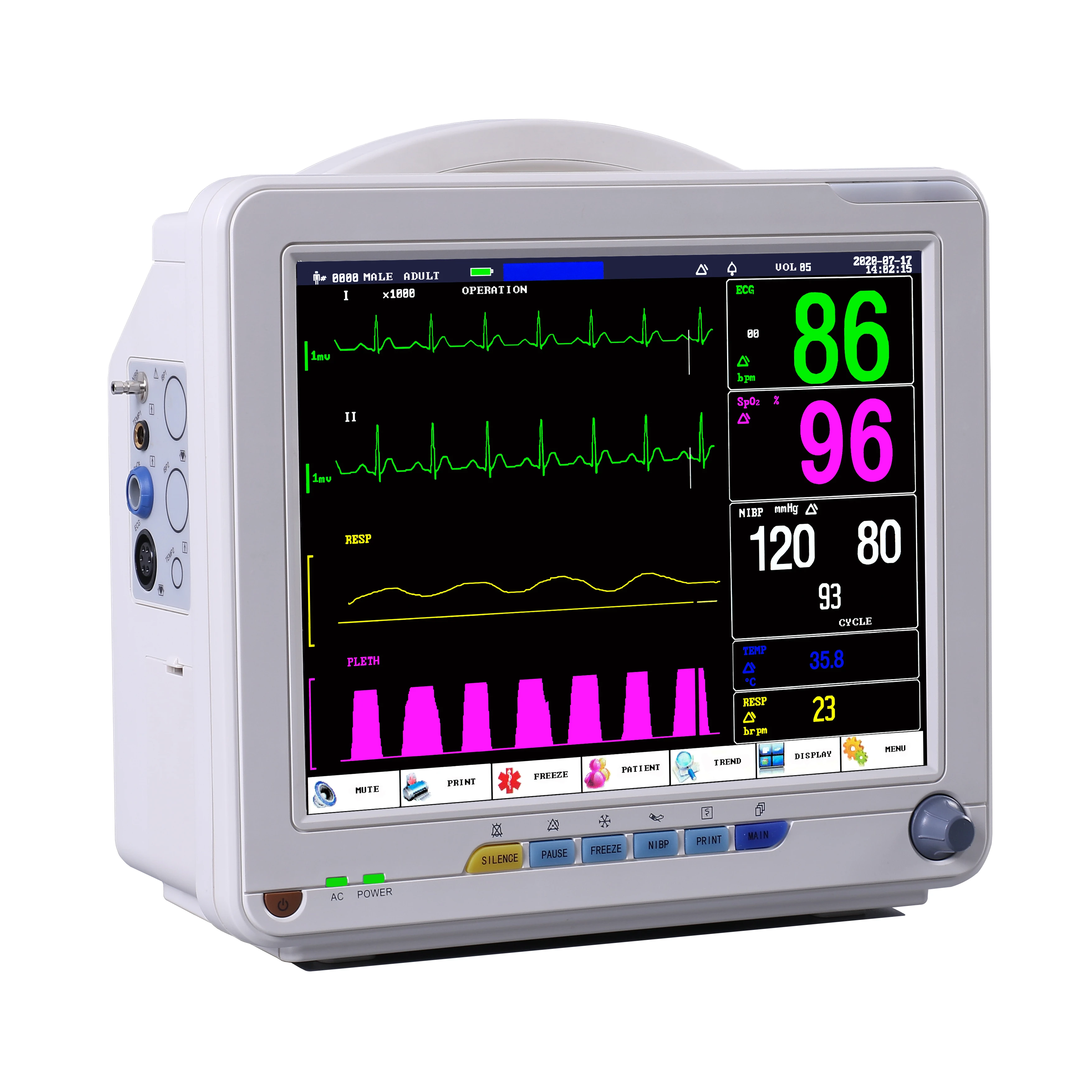 12.1 Inch Portable Animal Vet ICU Multiparameter Vital Signs Monitor ECG ETCO2 Pet Monitor