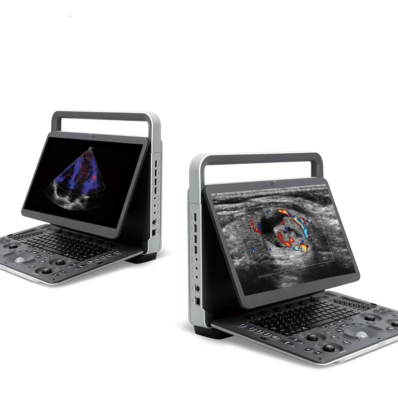 Medical Ultrasound Instruments Sonoscape E1 Black white Ultrasound machine Scanner Analyzer with Pw