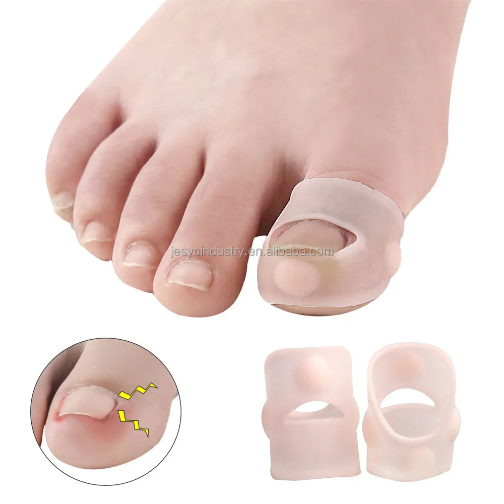 Foot Care Accessory Big Toe Nail Silicone Dot Corrector Ingrown Toenail Paronychia Treatment Tool Elastic Silicon Toenail Sleeve
