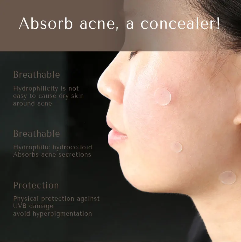 Korean Natural Transparent Face Oil Acne Patches For Covering Zits And Blemishes Private Label