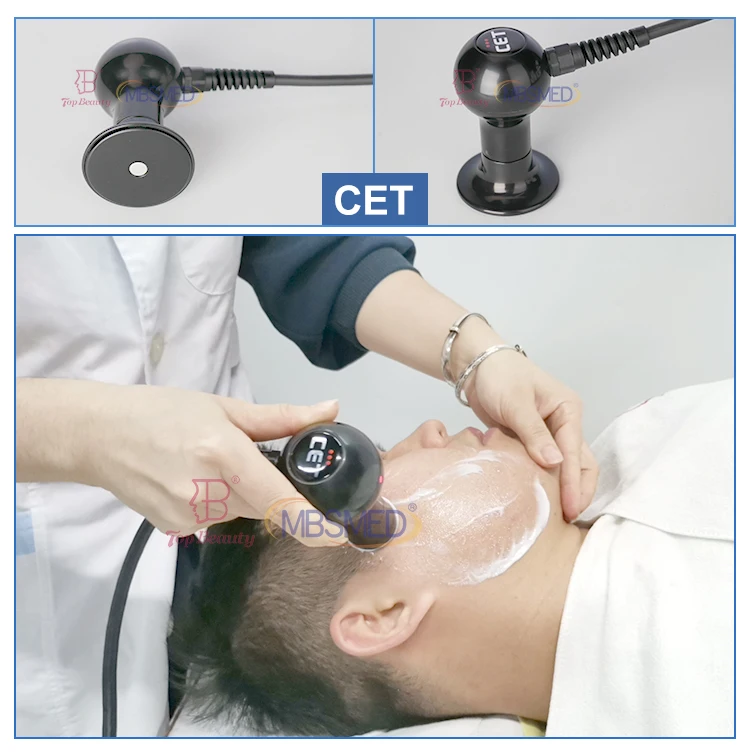 Indiba 448khz Radiofrecuencia Fraccionada Facial Lifting Inner Ball Roller Rf Body Slimming Machine