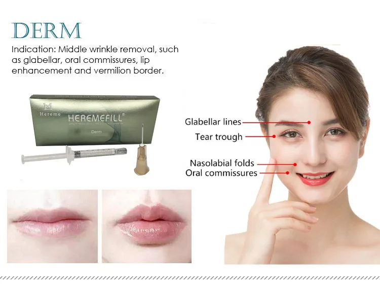 Wholesales Price 24mg/ML Ha Dermal Filler Injection Cross Linked Hyaluronic Acid Korea Dermal Filler
