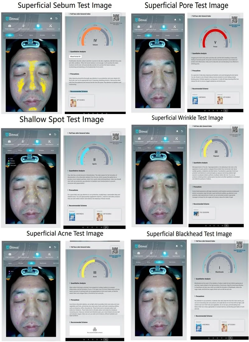 Portable Professional 3d Face Measuring Machine 3d Small Facial Skin Diagnostics Analyzer Skin Analysis System 13 Languages