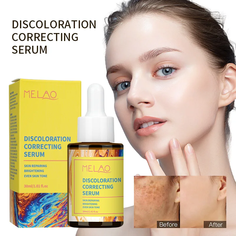 Private Label Tranexamic Acid Niacinamide Whitening Serum Sun Damage Repair Skincare Face Correcting Serum Discoloration Serum