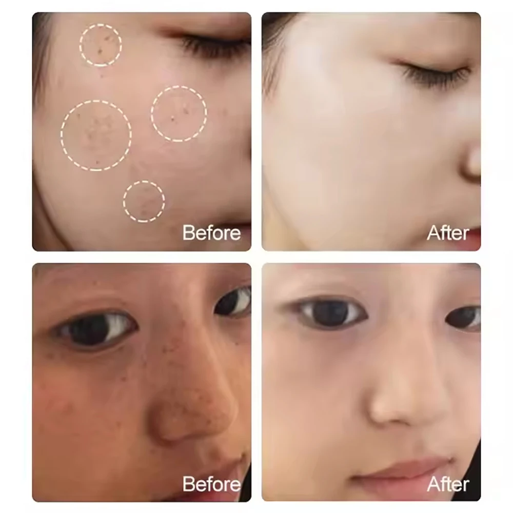 Korea glutathione Kojic Acid Skincare Serum Skin Whitening Facial Serum anti aging for Dark Spots Remover