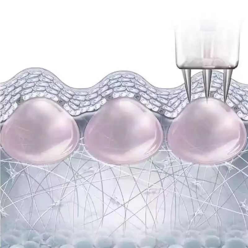 3Pin Nanosoft заполненный микроиголкой 0 6 мм микроиголка для антивозрастных круглых глаз и