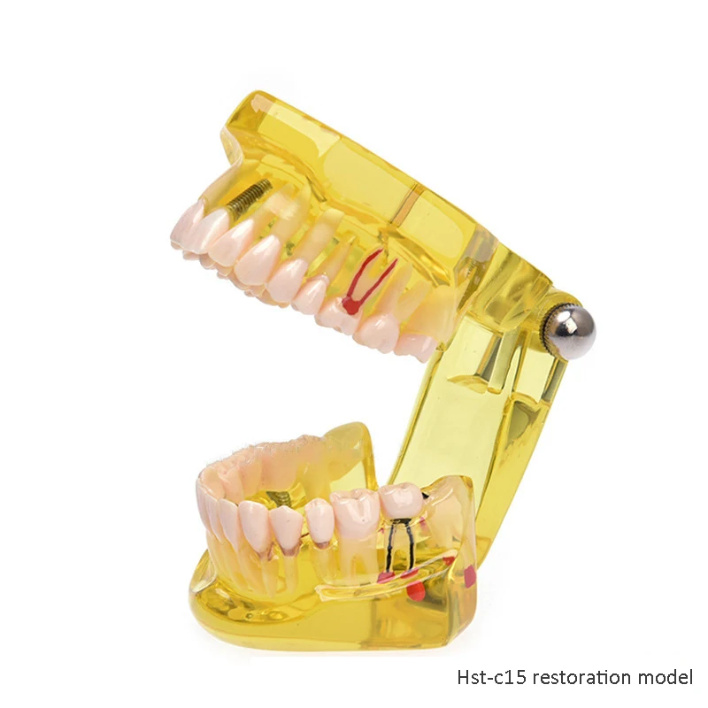 High quality lab typodont dental model practice dental implant model