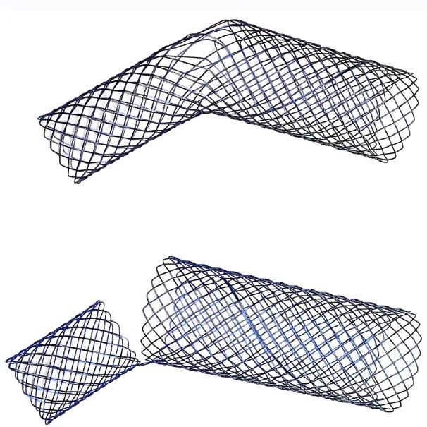 Medical Nitinol Expandable Duodenal Stent Silicone Covered Intestinal Stent