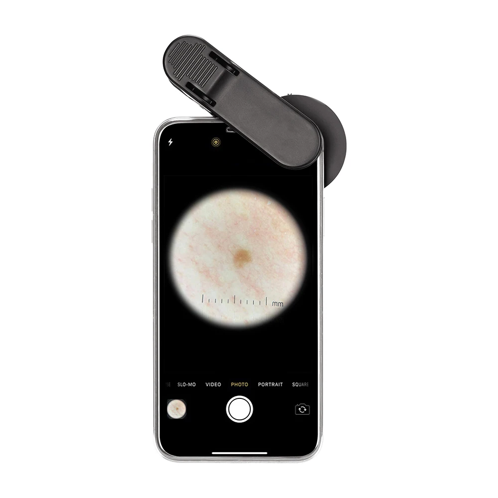 Skin Loupe & Magnifier - Dermoscope Compatible with iPhone, iPad and Android Phones