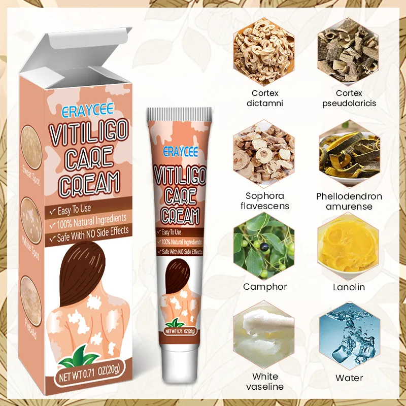 Vitiligo Safe and Effective Treatment Cream White Spot Ointment Flower Spot Sweat Purpura Skin Topical Ointment