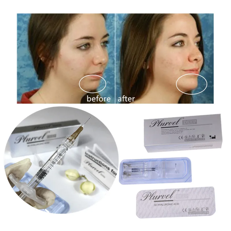 Plurvel Filler Ha Hyaluronic Acid Dermal Filler Facial Filler For Forehead Nose Lips Chin Face Anti-wrinkle Made By Manufacturer