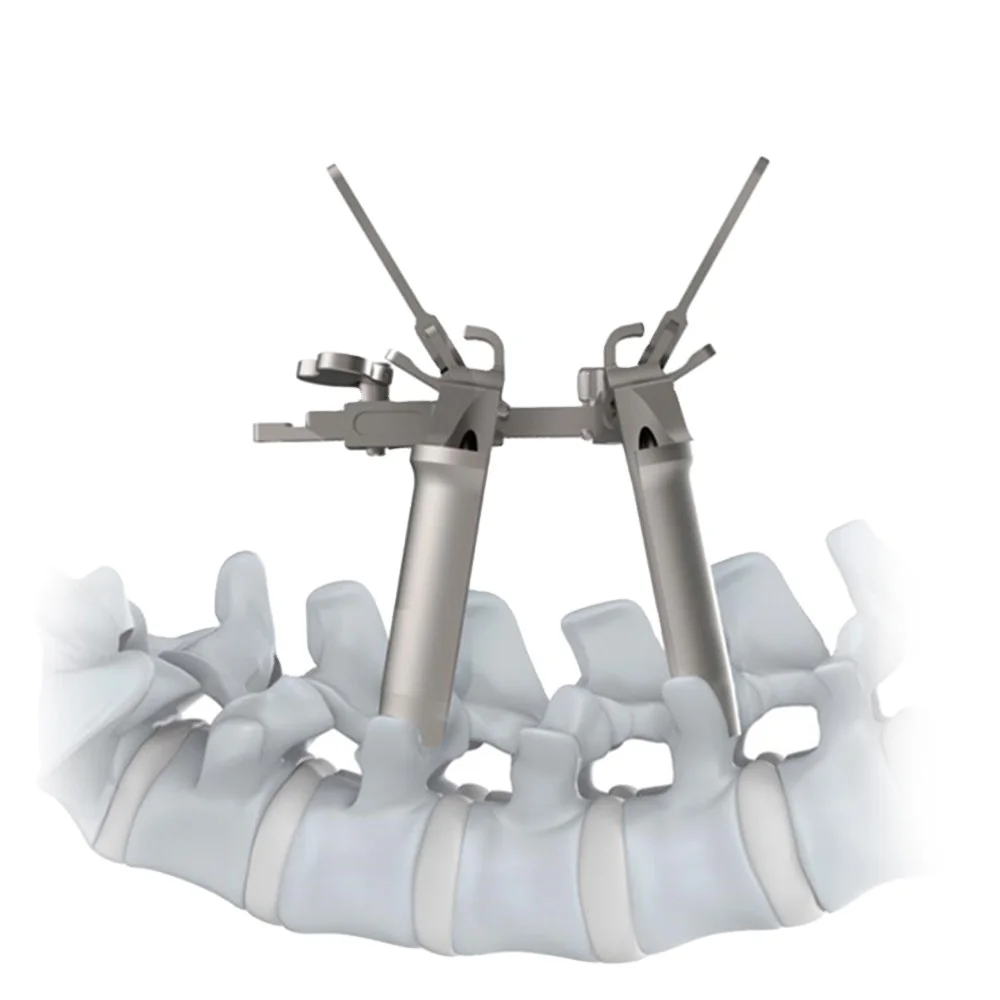 CANWELL CanMIC MIS системный Минимальный доступ позвоночник канал костные Хирургические Инструменты