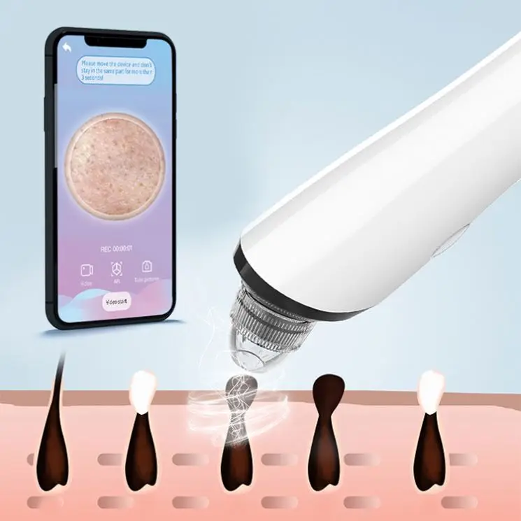 Electric Pore Cleaner Remover Machine Black Head Blackhead Acne Removal Tool Kit Set Bubble Vacuum Blackhead Remover