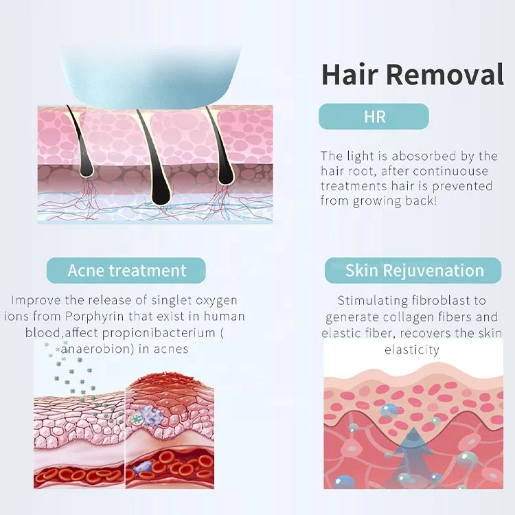 DEESS Home Use Hair Removal Portable Ipl Laser Hair Removal 800000 Shots