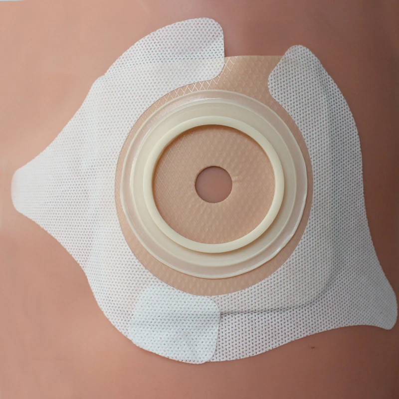 Y-образная гидроколлоидная остамия, эластичные полоски для удлинения барьера кожи