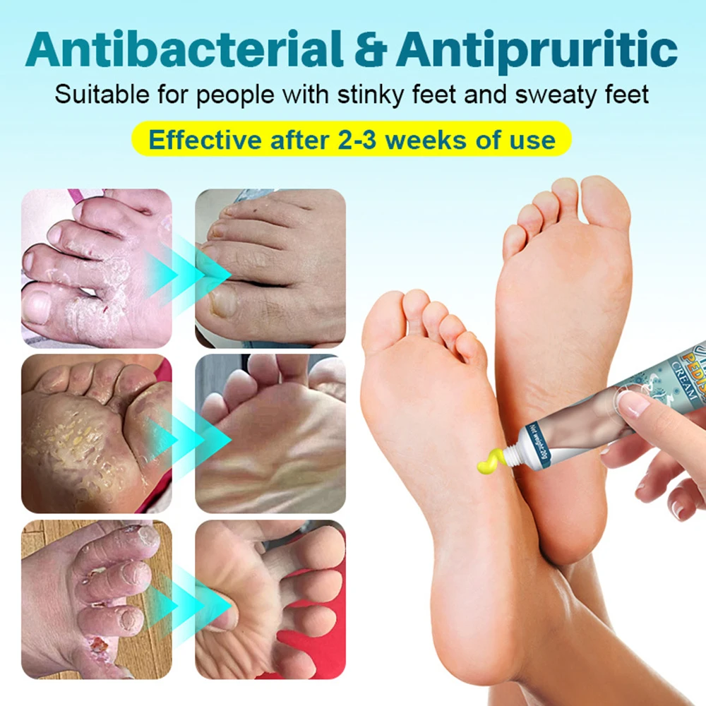 KanyeHB Beriberi Ointment Foot Odor Care Cream for foot skin health care for dermatophytosis disease and dietetic neuritis