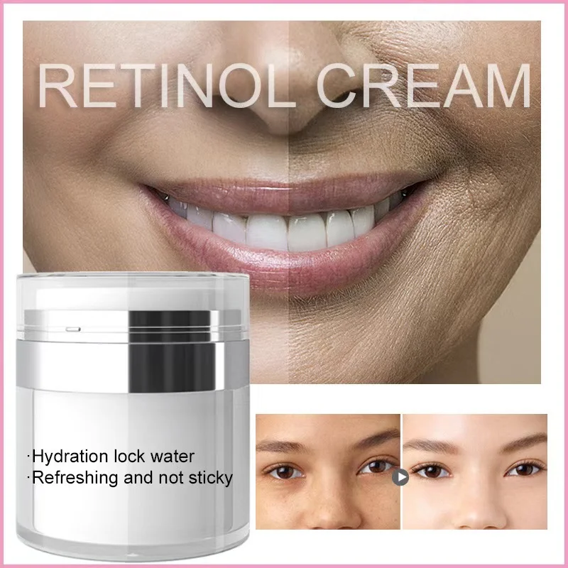 Customized retinol cream vitamin A moisturizing moisturizing cream spot wholesale
