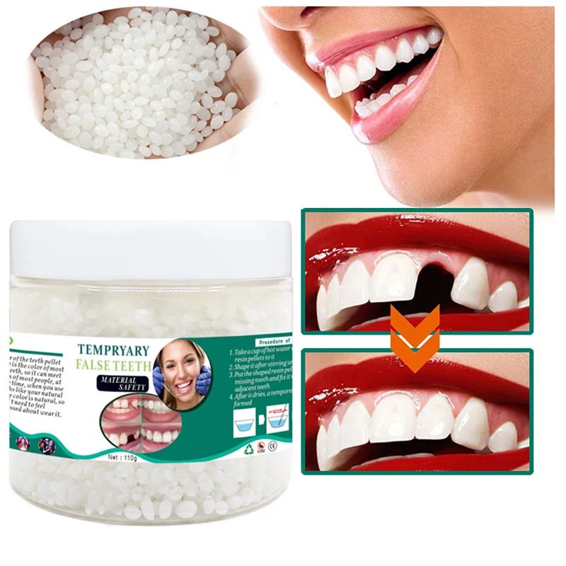 OEM Temporary tooth repair kit Glue gap fillers for broken teeth Missing tooth repair kit Homemade glue dentures