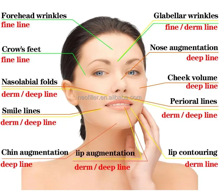 Factory Price Cross Linked Hyaluronic Acid Korea Ha Injectable Dermal Filler