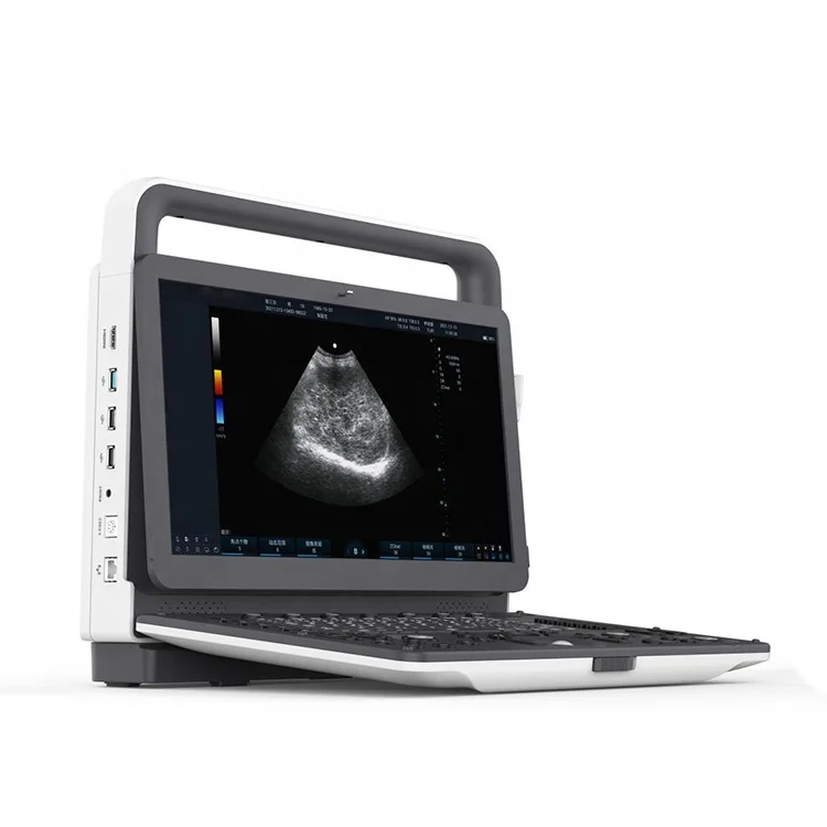 YSB-M30 VET Portable Hifu(high Intensity Focused Ultrasound) 3D 4D Color Doppler Ultrasound Diagnostic Device Equine Ultrasound