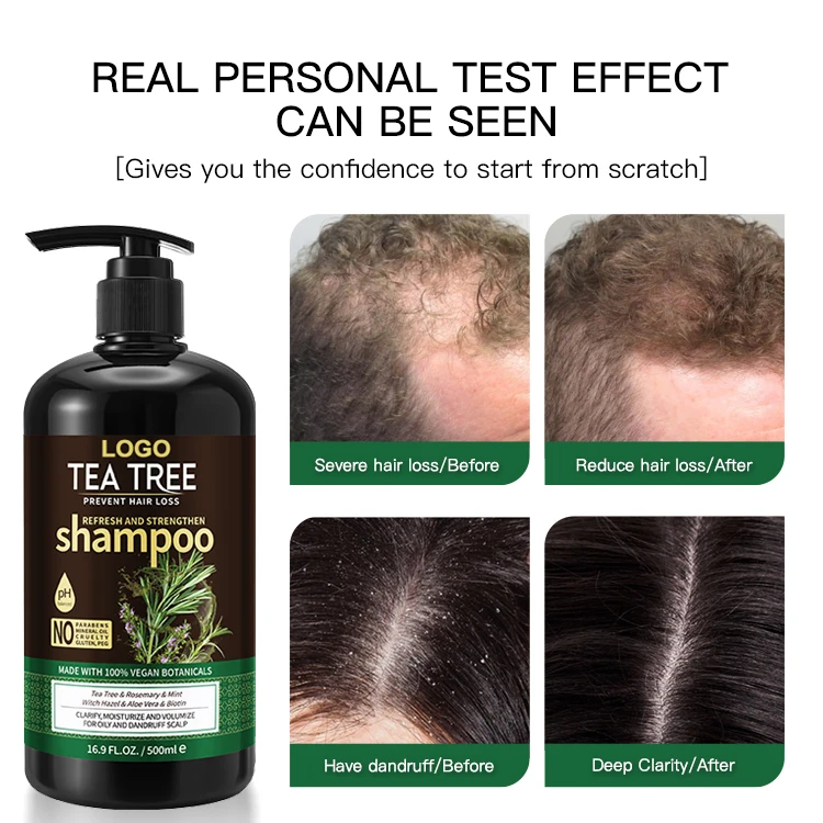 Customized Anti Dandruff Shampoo Organic Tea Tree Keratin Anti Hair Loss Sulfate Free Shampoo And Conditioner