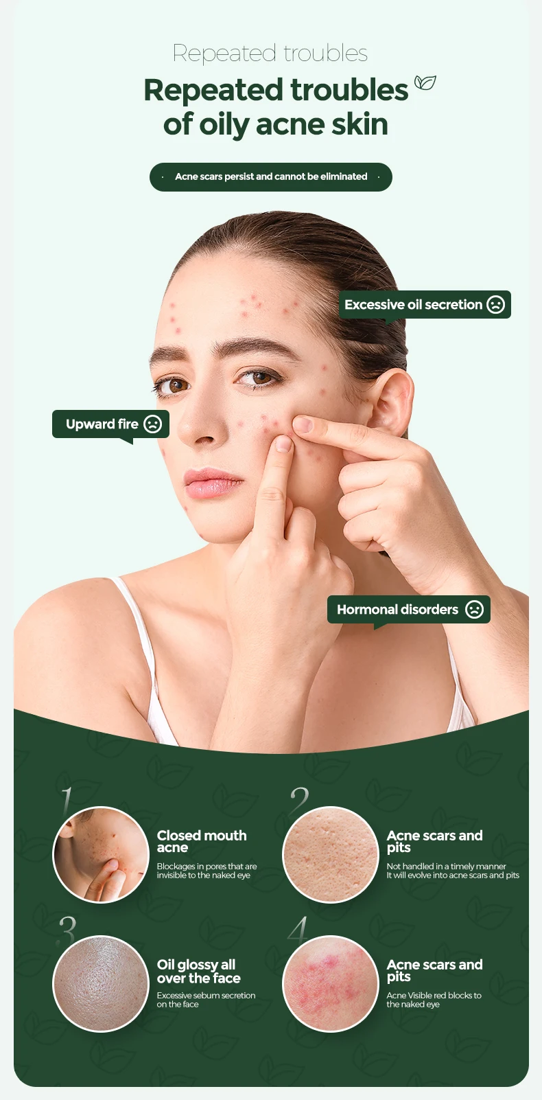 anti effective treatment face for pimples 12 hour 5 day acid ccar removal and whitening clearing gel control acne cream acnes