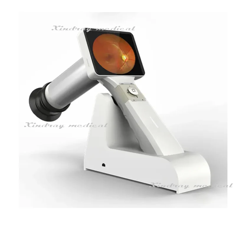 China Ophthalmic Hfc Auto Digital Eye Retinal Photography Cheap Hand Hold Fundus Camera