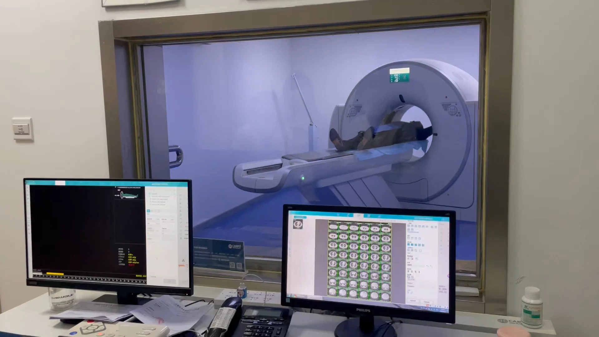 Radiology Equipment X-ray machine 24-slice 32-slice CT scan machine medical