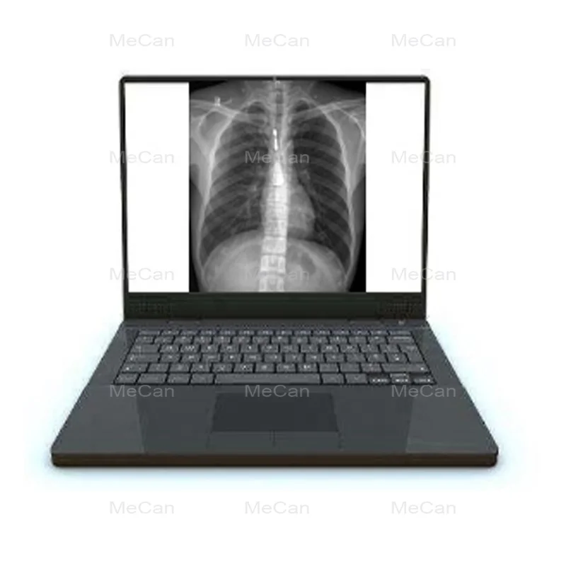  Переносной рентгеновский аппарат Digital X Ray Machine Храктеристика устройства: