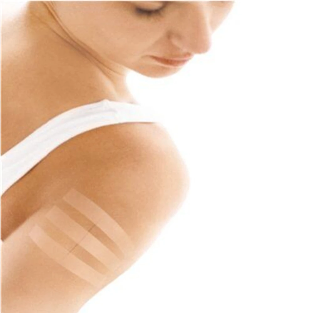 Wound skin closure surgical in medical adhesive