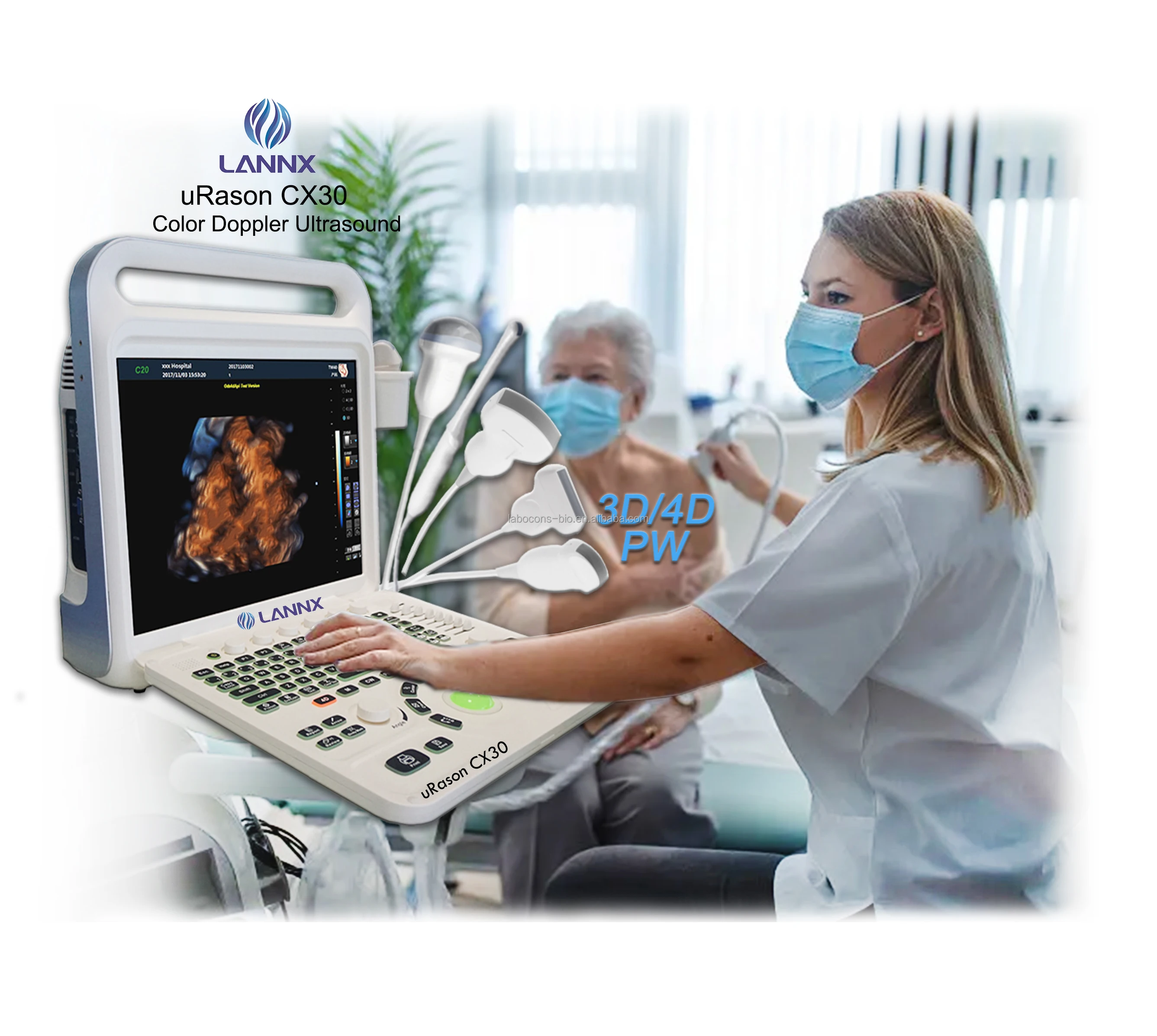 LANNX uRason CX30 New Design Digital Color Doppler Ultrasound Scanner ecografo System 3D/4D optional ultrasonido machine