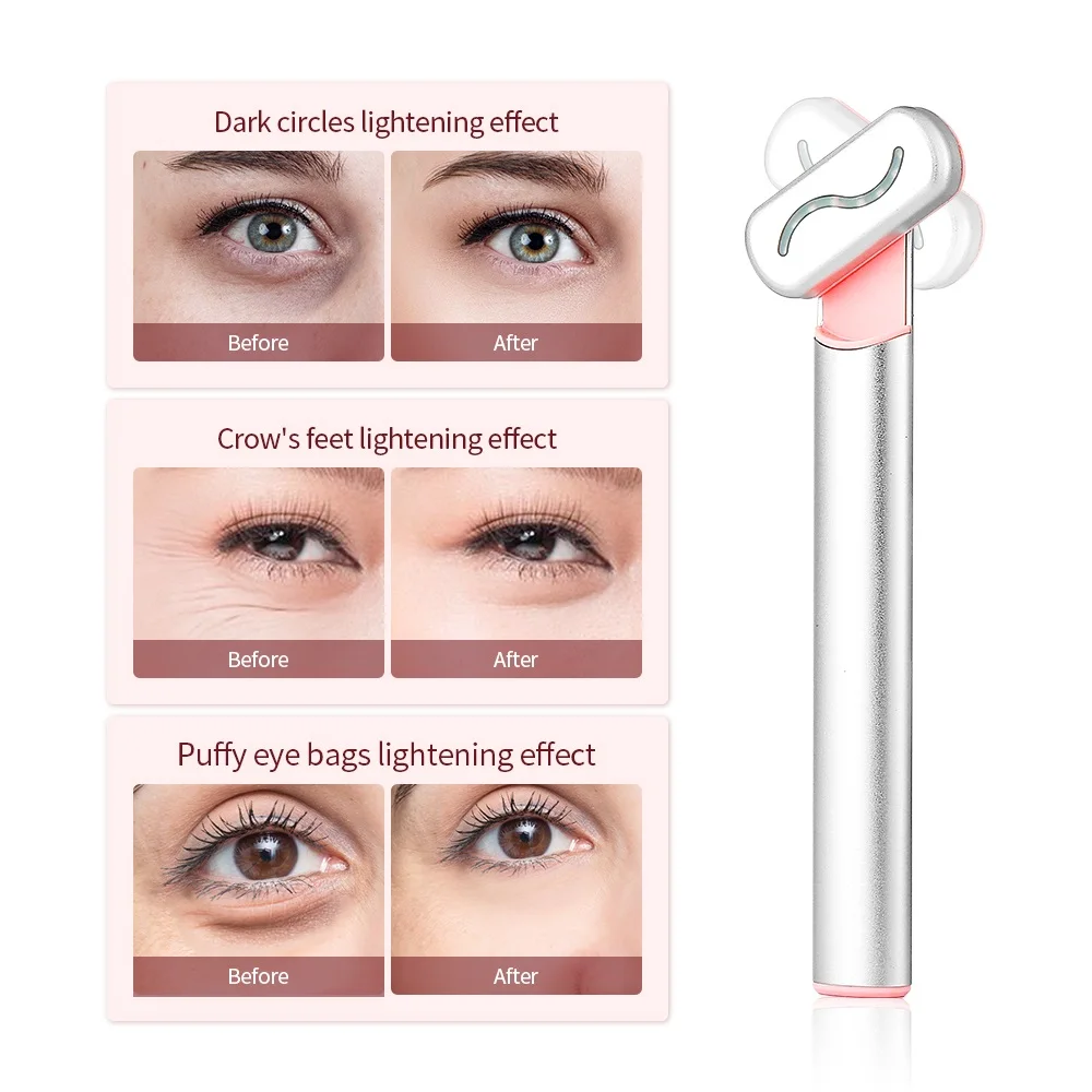 KKS skin tightening eye dark circle removal red led ems hot compress electric smart eye massager wand